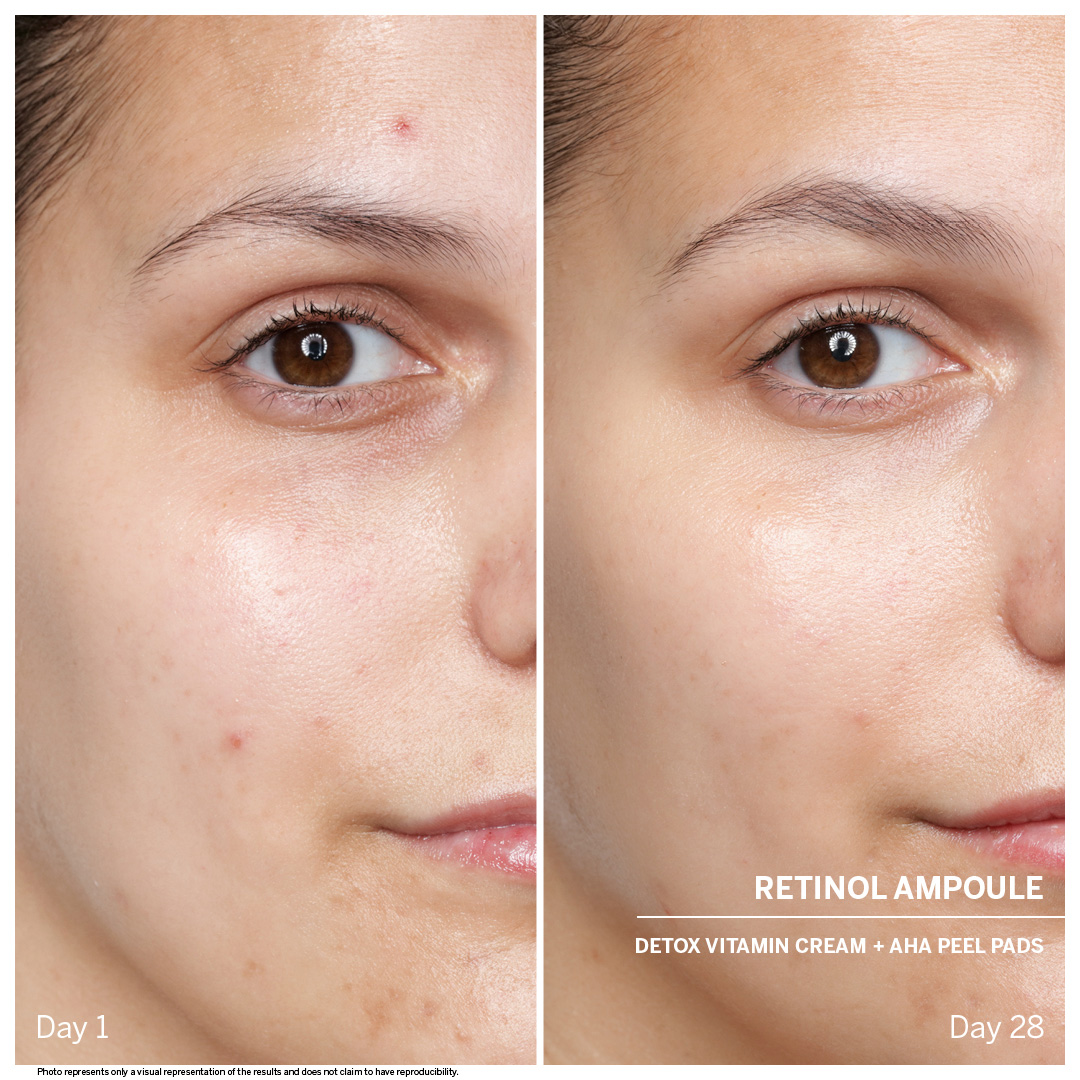 Retinol Wirkung & Anwendung auf der Haut